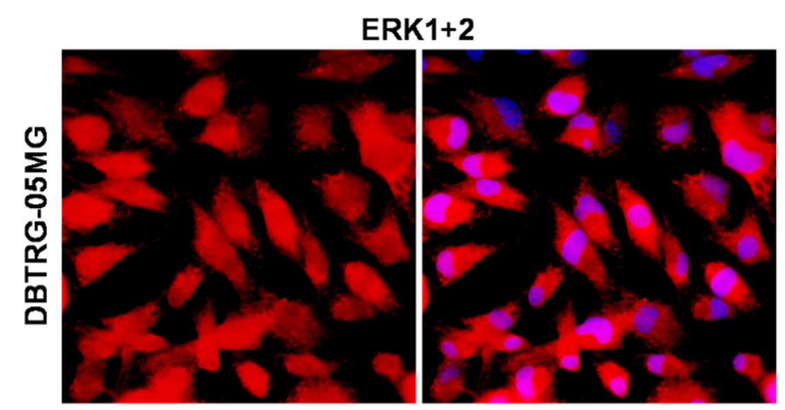 IR187-705 anti-ERK1+ERK2 antibody ICC/IF image