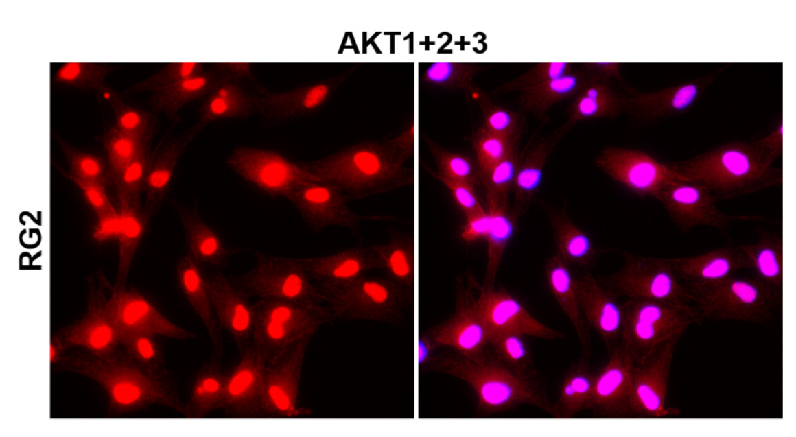 IR171-666 anti-AKT (pan) antibody ICC/IF image