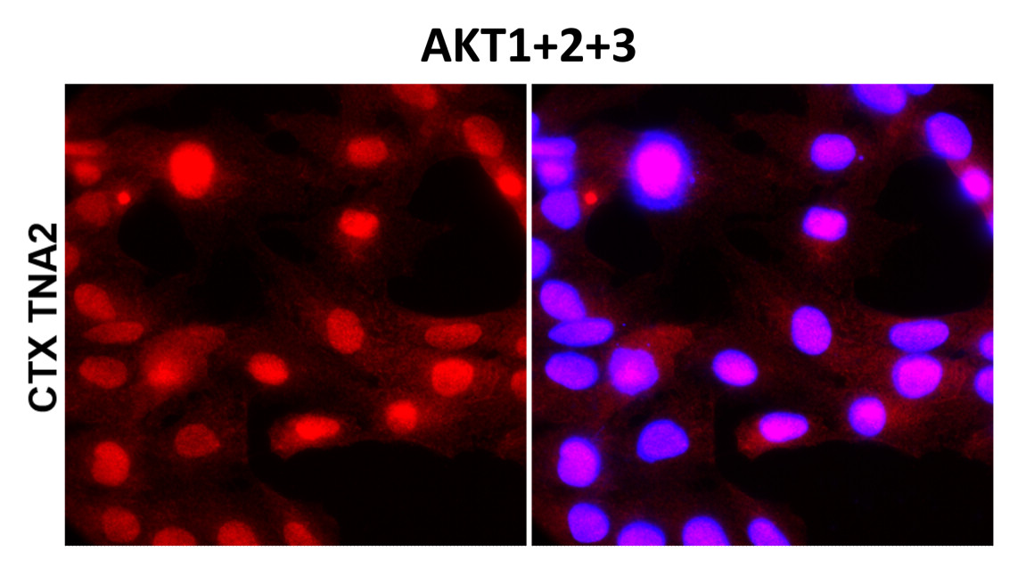 IR171-666 anti-AKT (pan) antibody ICC/IF image IR171-666 anti-AKT (pan) antibody ICC/IF image