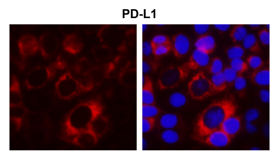 IR167-645 anti-PD-L1 antibody ICC/IF image IR167-645 anti-PD-L1 antibody ICC/IF image