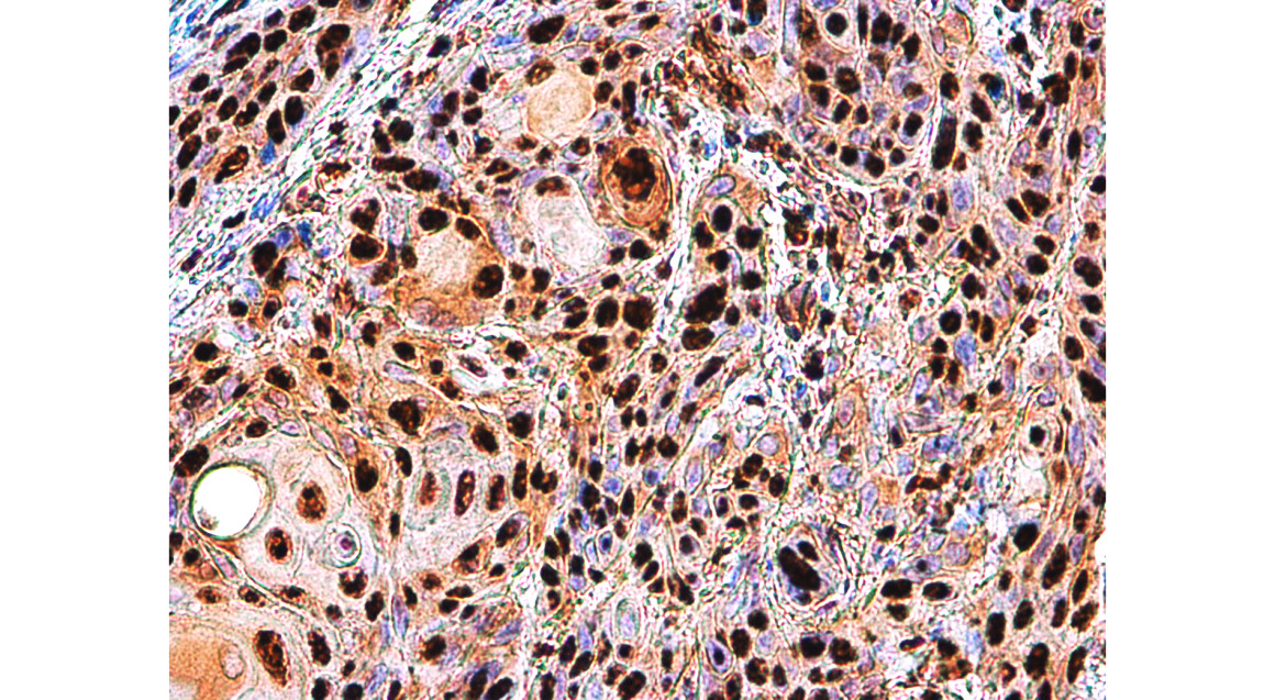 IR101-420 anti-PARP cleaved antibody IHC image