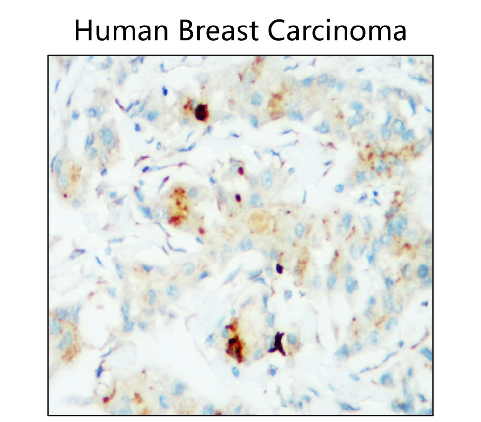 IR167-643 anti-PD-L1 antibody IHC image IR167-643 anti-PD-L1 antibody IHC image