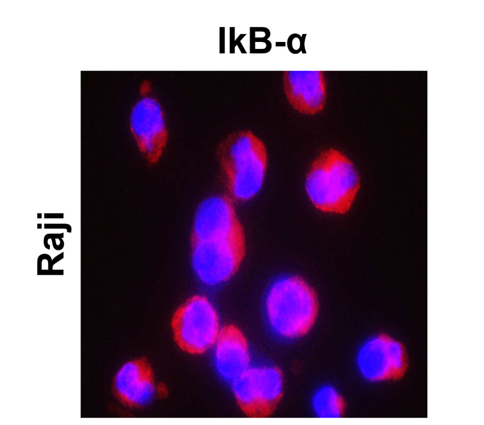 IR145-580 anti- IκBα antibody ICC/IF image IR145-580 anti- IκBα antibody ICC/IF image