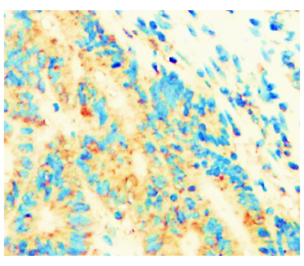 IR145-580 anti- IκBα antibody IHC image IR145-580 anti- IκBα antibody IHC image