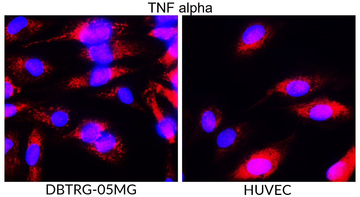 IR106-P2 anti-TNF alpha antibody ICC/IF image IR106-P2 anti-TNF alpha antibody ICC/IF image