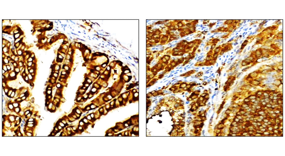 IR137-549 anti- NF-kB p65 antibody IHC image IR137-549 anti- NF-kB p65 antibody IHC image