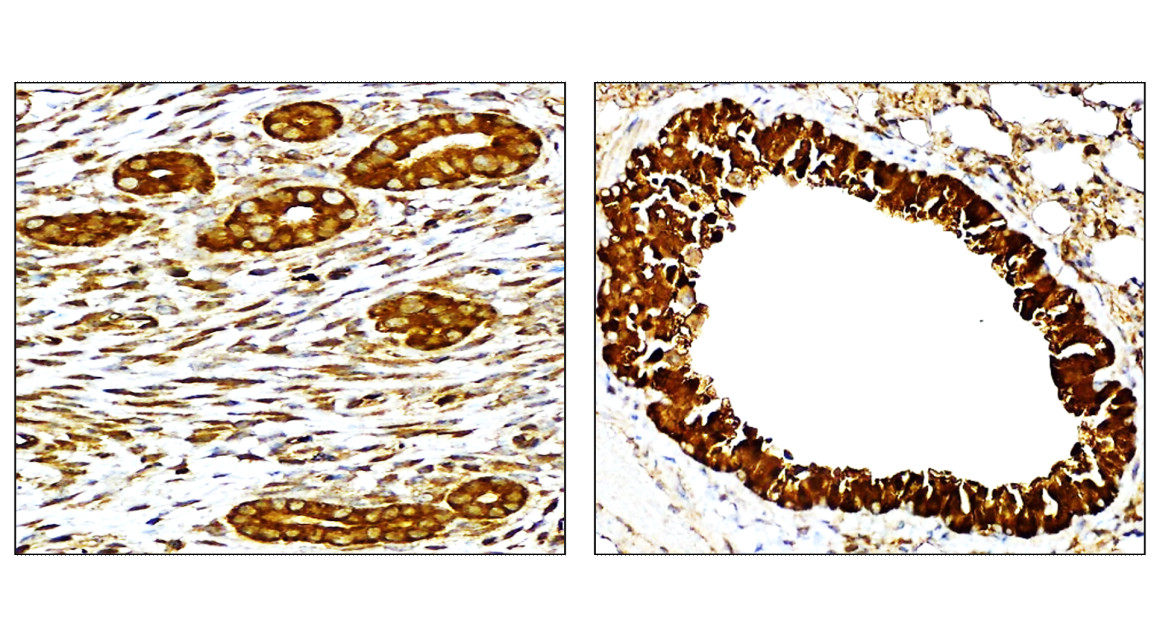 IR137-549 anti- NF-kB p65 antibody IHC image IR137-549 anti- NF-kB p65 antibody IHC image