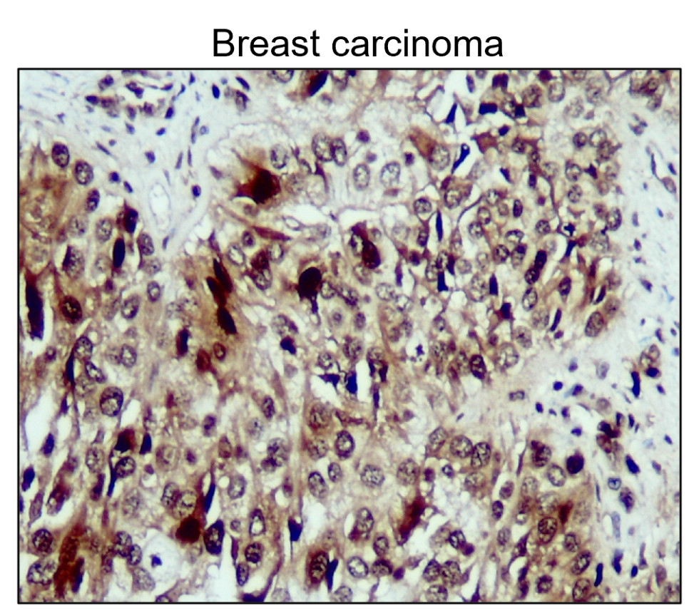 IR136-543 anti-NRF2 antibody IHC image