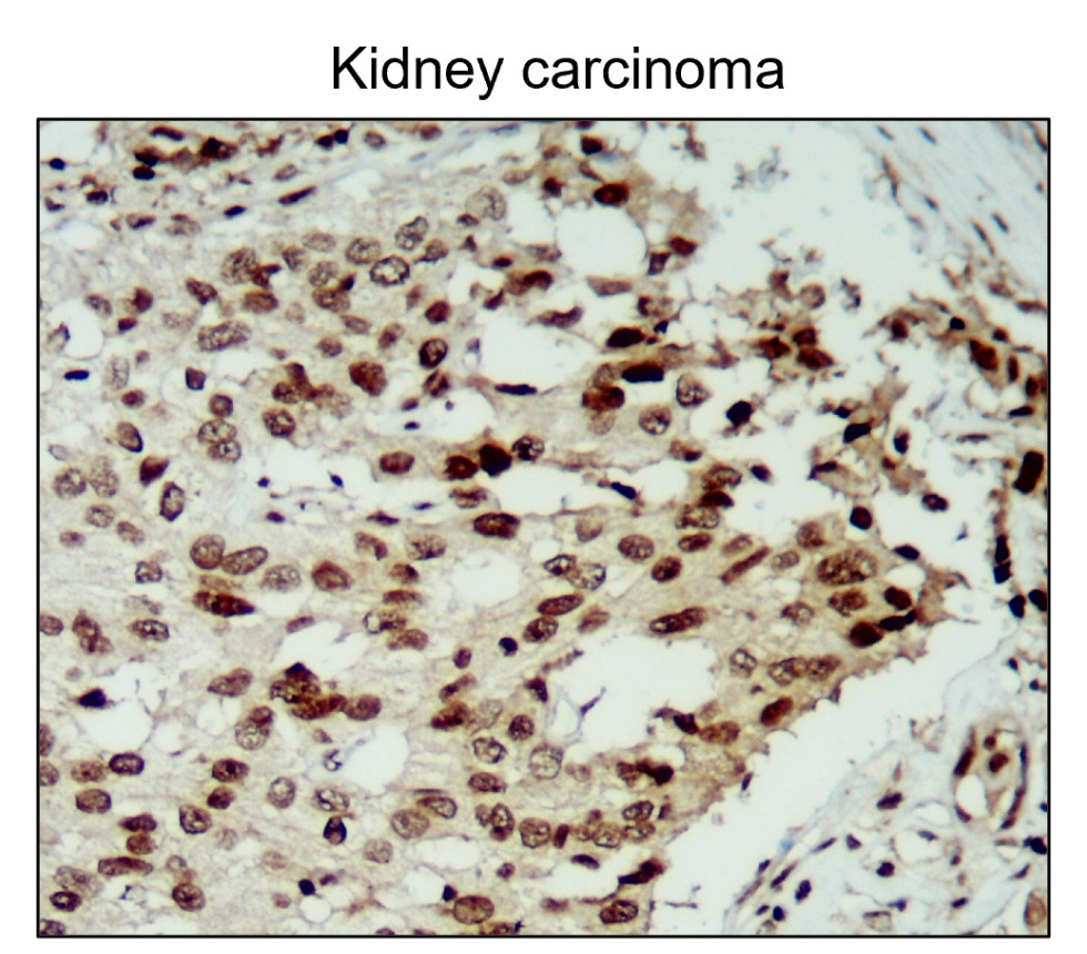 IR136-543 anti-NRF2 antibody IHC image