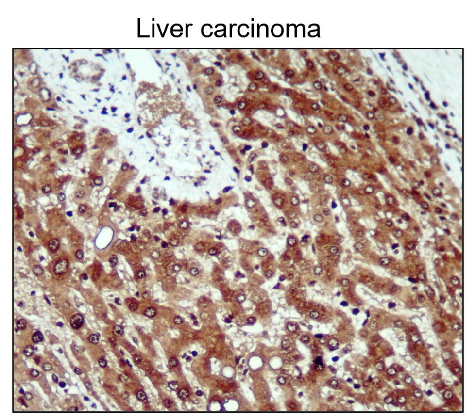 IR136-543 anti-NRF2 antibody IHC image