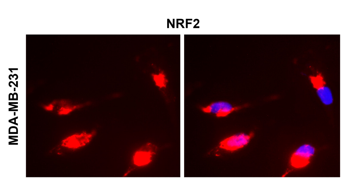 IR136-543 anti-NRF2 antibody ICC/IF image