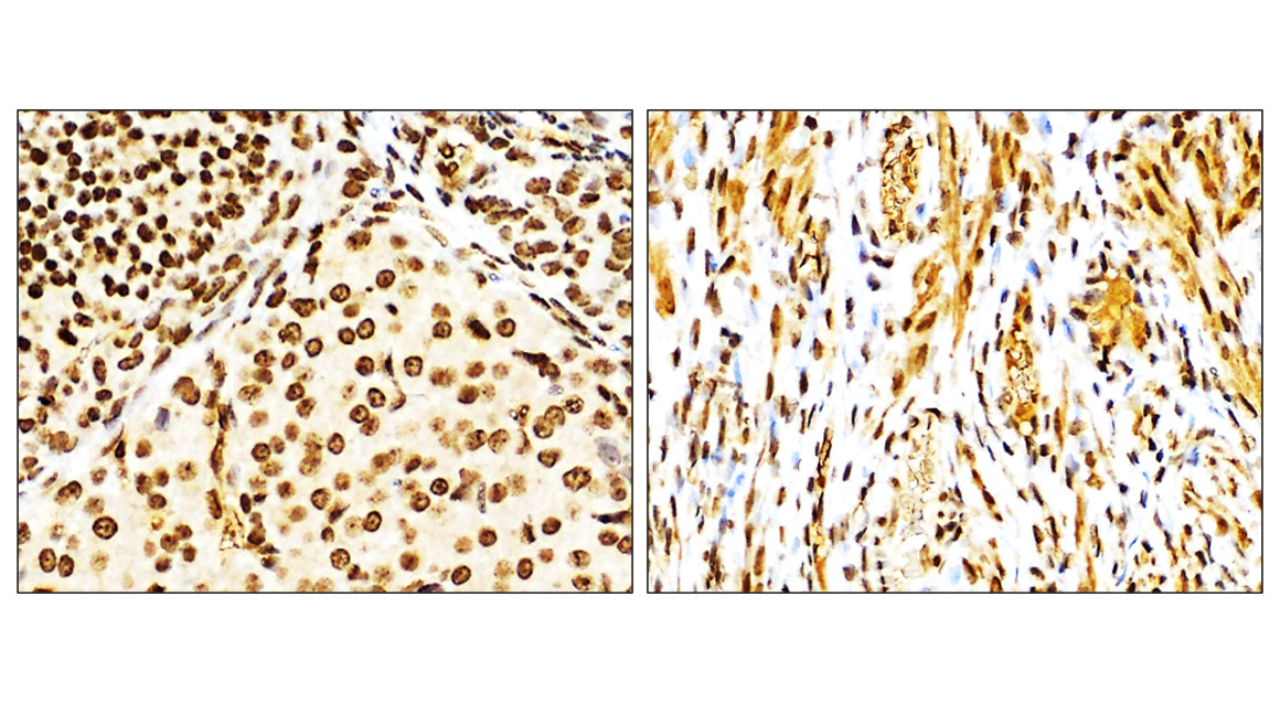 IR136-543 anti-NRF2 antibody IHC image