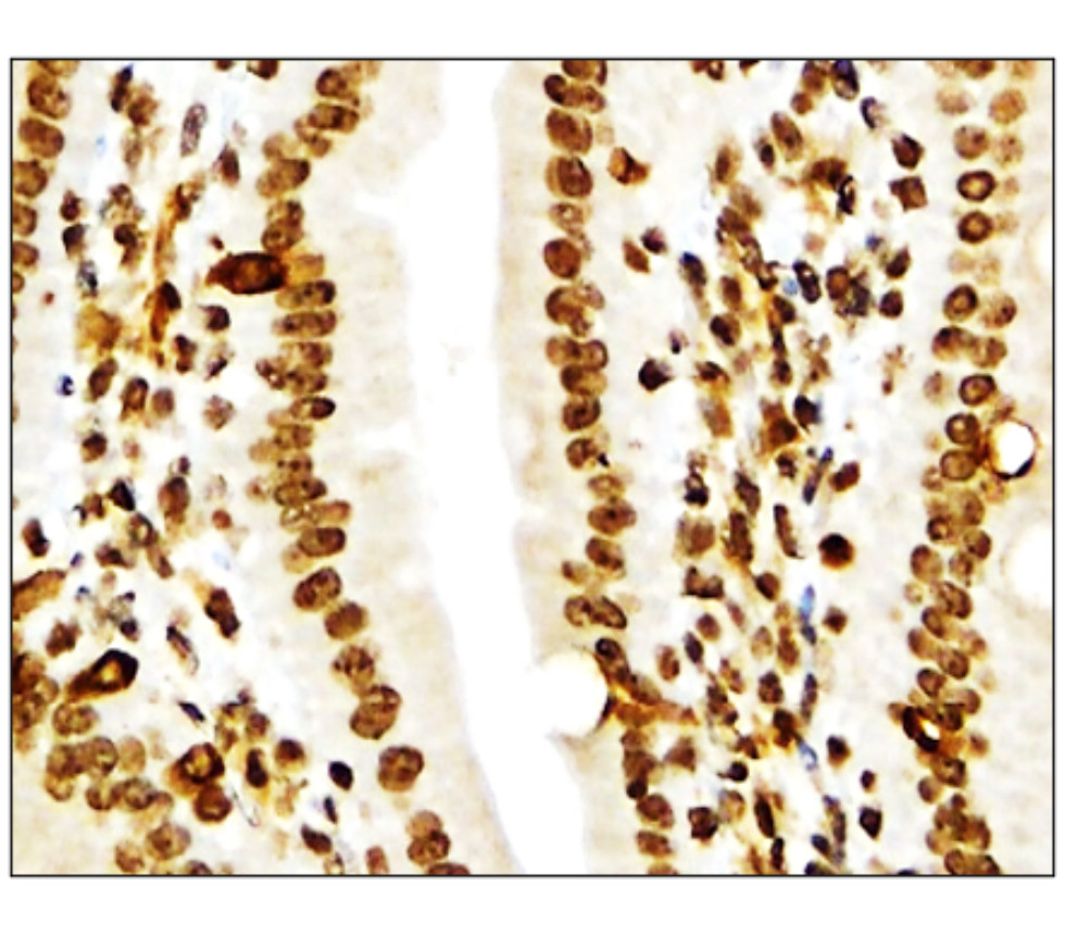 IR136-543 anti-NRF2 antibody IHC image