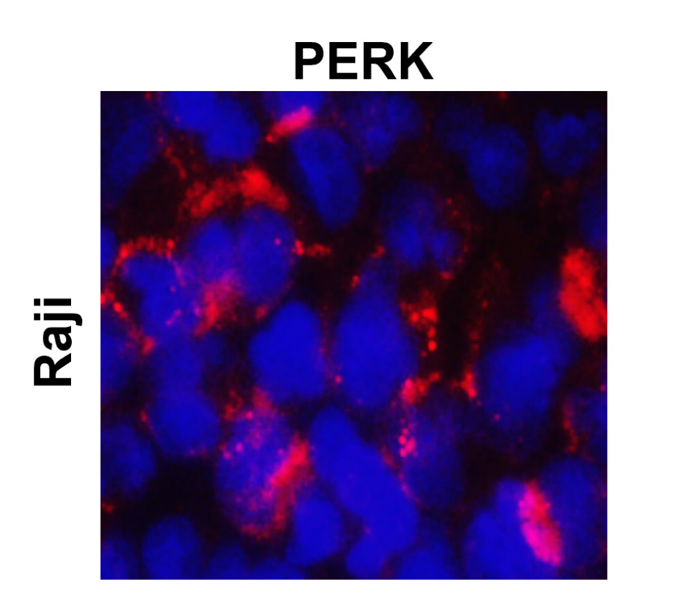 IR135-538 anti-PERK antibody ICC/IF image IR135-538 anti-PERK antibody ICC/IF image