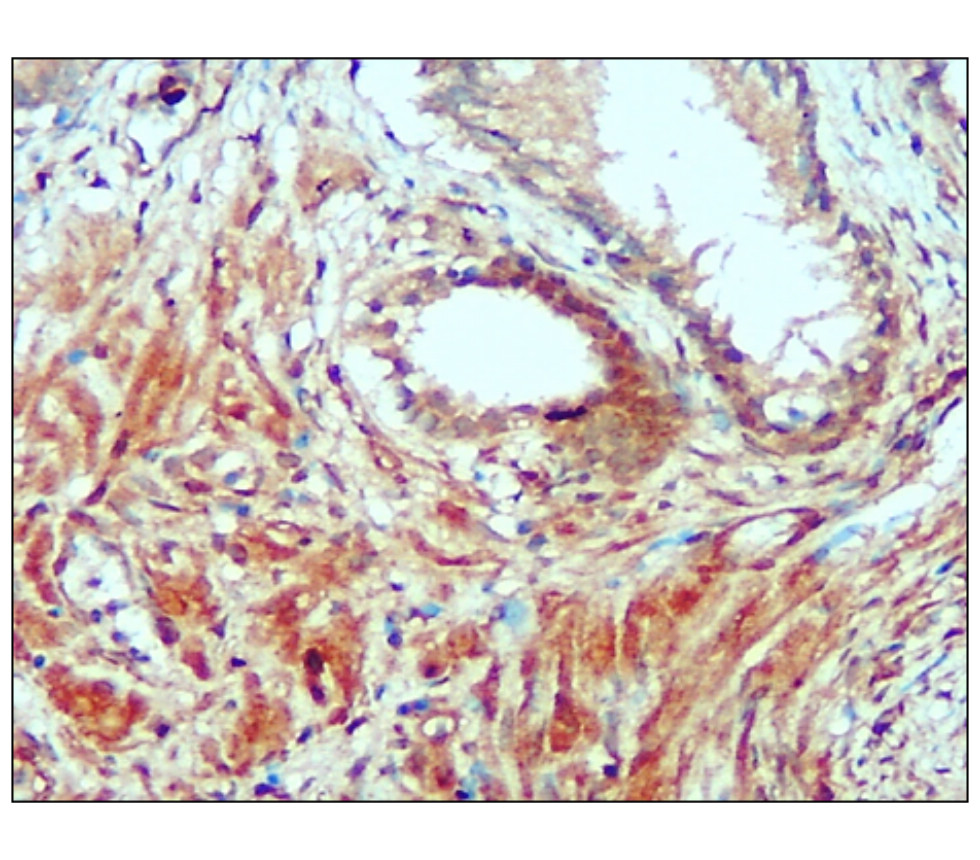 IR135-538 anti-PERK antibody IHC image
