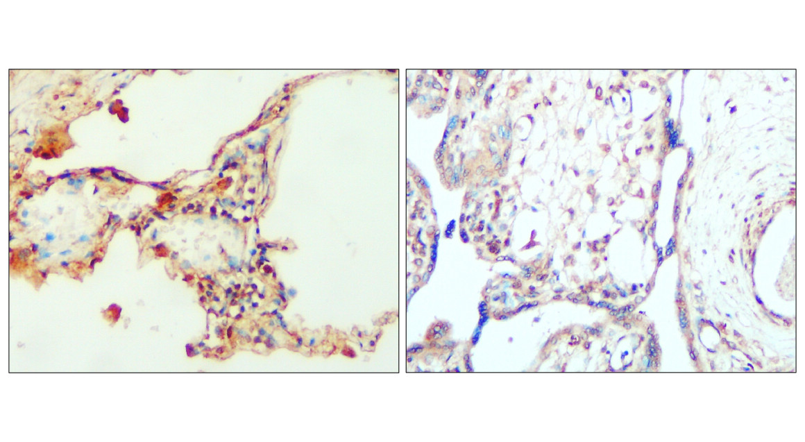 IR135-538 anti-PERK antibody IHC image