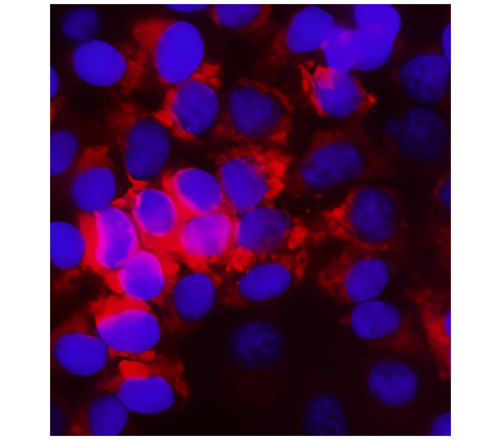 IR133-535 anti-eIF2 alpha antibody ICC/IF image IR133-535 anti-eIF2 alpha antibody ICC/IF image