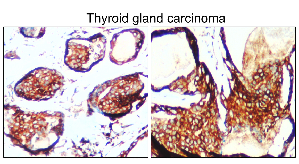 IR130-525 anti-BiP / GRP78 antibody IHC image IR130-525 anti-BiP / GRP78 antibody IHC image