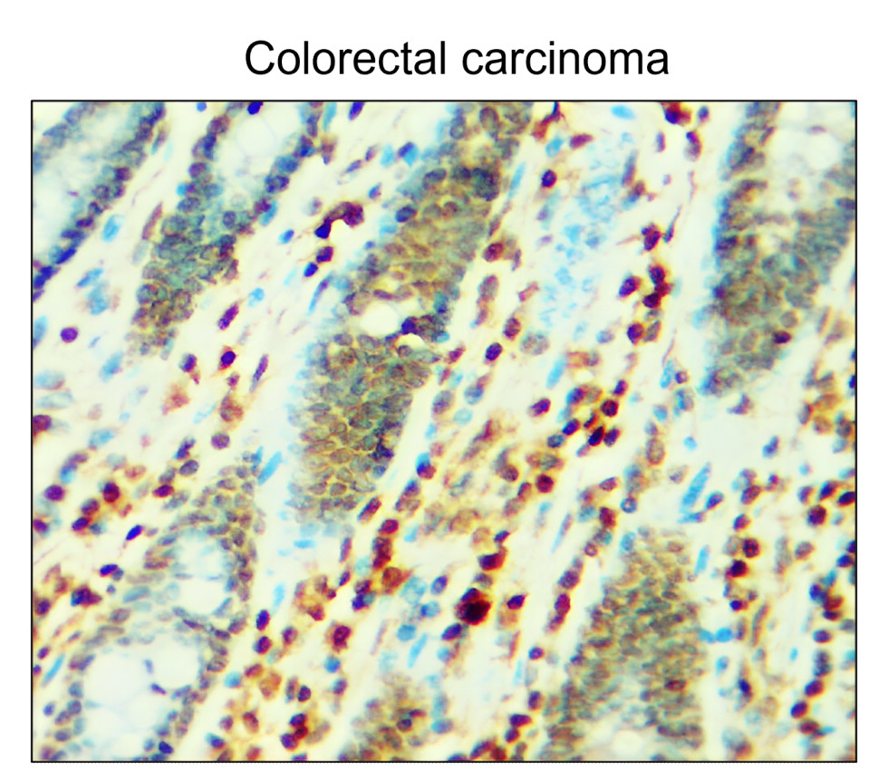 IR122-312 anti-p21 Cip1 antibody IHC image