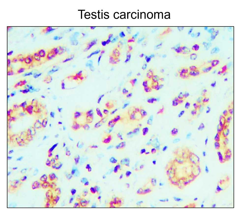 IR122-312 anti-p21 Cip1 antibody IHC image IR122-312 anti-p21 Cip1 antibody IHC image