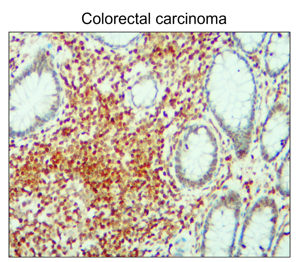 IR122-312 anti-p21 Cip1 antibody IHC image IR122-312 anti-p21 Cip1 antibody IHC image