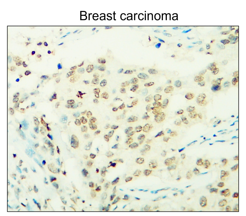 IR122-312 anti-p21 Cip1 antibody IHC image