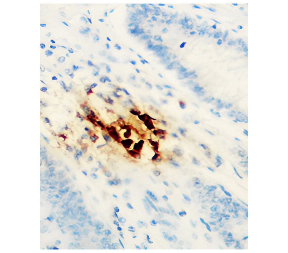 IR119-300 anti-Cyclin E1 antibody IHC image IR119-300 anti-Cyclin E1 antibody IHC image