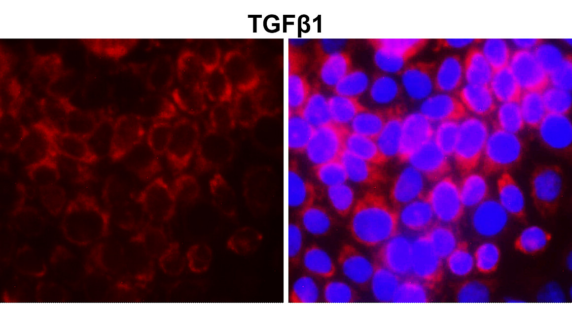 IR112-457 anti TGF beta 1 antibody ICC/IF image