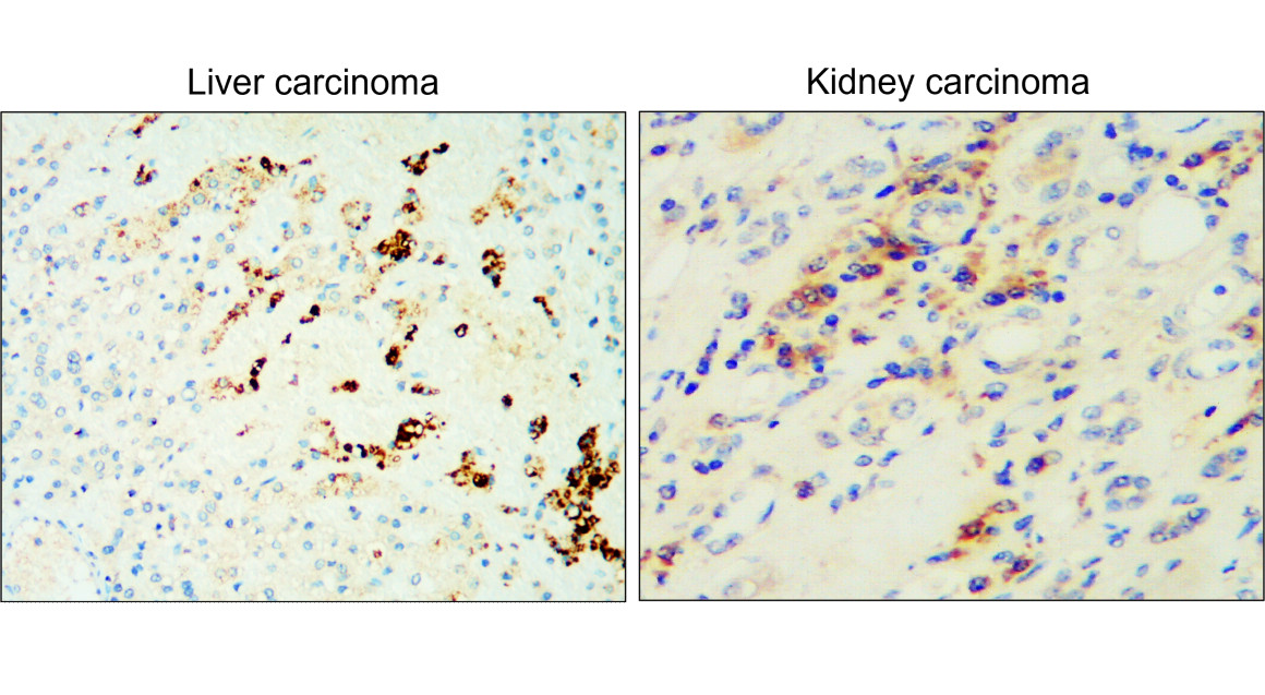 IR112-457 anti TGF beta 1 antibody_Liver & Kidney IHC image