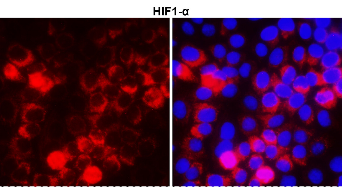 IR113-466 anti-HIF1 alpha antibody ICC/IF image
