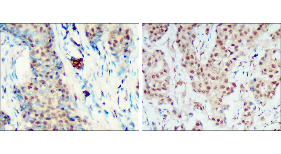 IR113-466 anti-HIF1 alpha antibody IHC image
