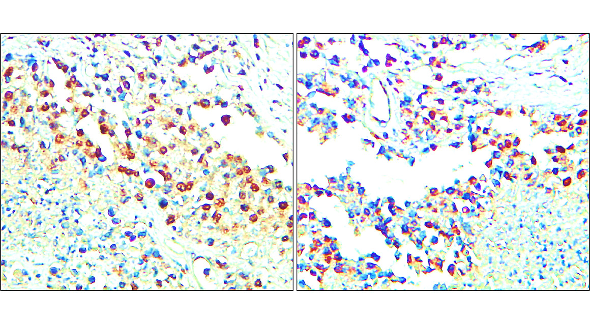IR157-621 anti- Chk2 antibody IHC image