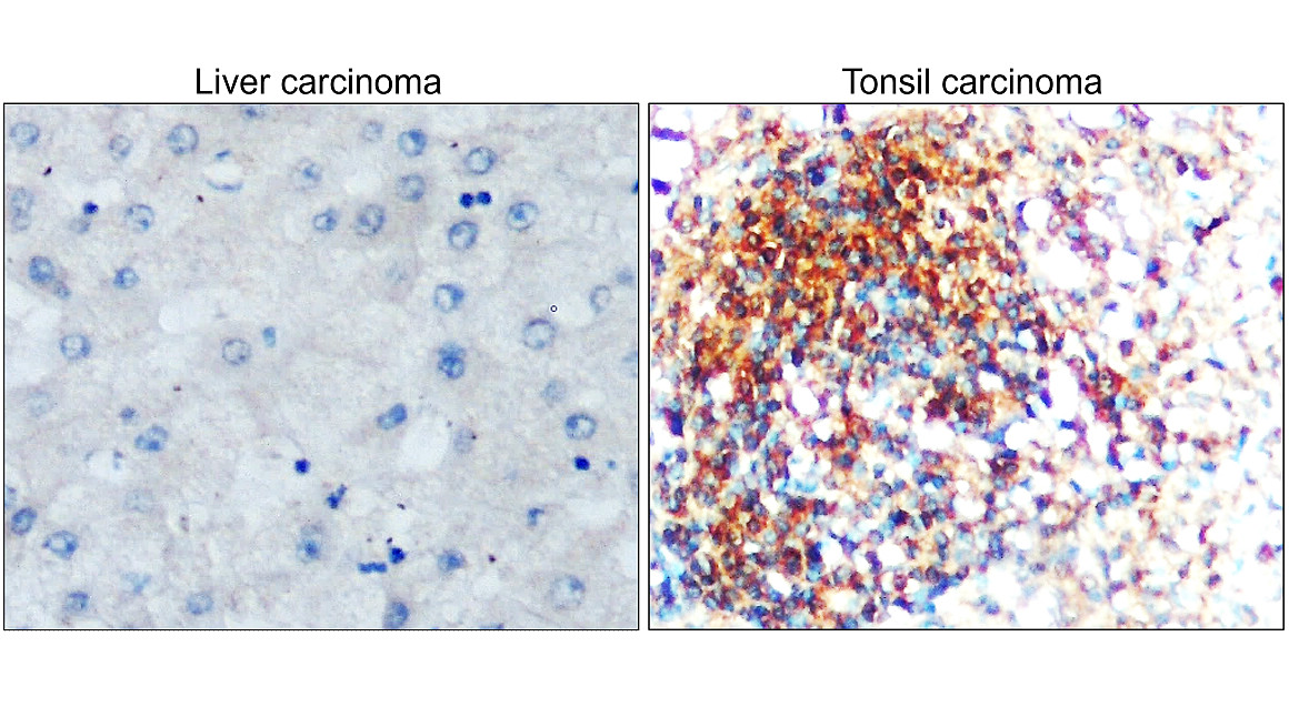 IR327-1032 anti- Toll-like Receptor 7 antibody IHC image IR327-1032 anti- Toll-like Receptor 7 antibody IHC image
