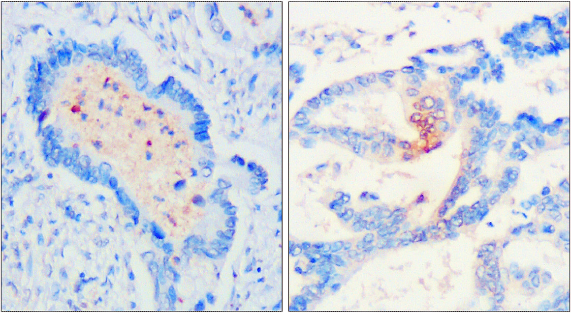 IR300-981 anti-CD9 antibody IHC image IR300-981 anti-CD9 antibody IHC image