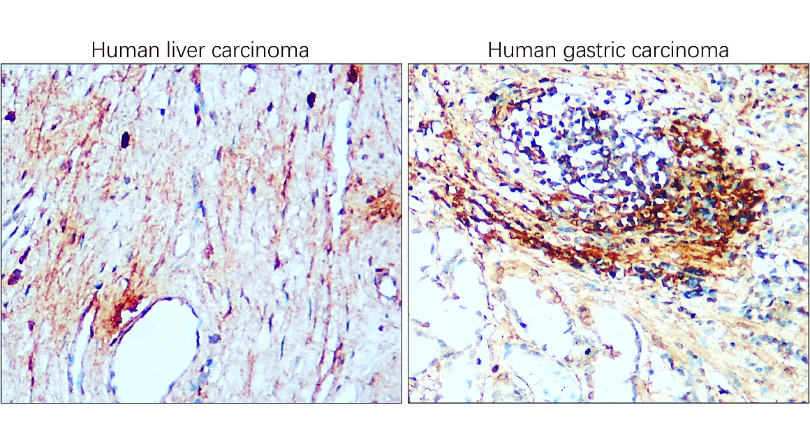 IR302-986 anti-CD81 antibody IHC image IR302-986 anti-CD81 antibody IHC image