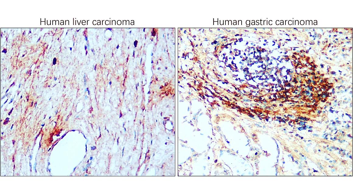 IR302-986 anti-CD81 antibody IHC image