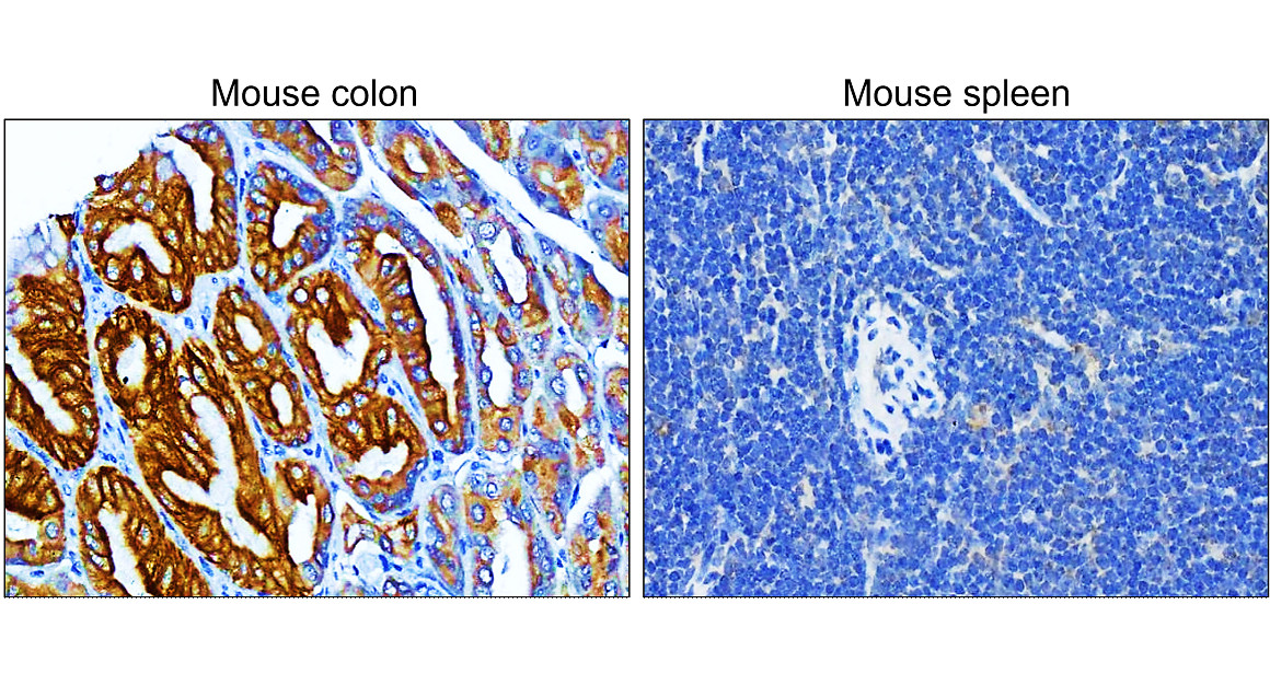 IR222-861 anti-pan Cytokeratin antibody IHC image IR222-861 anti-pan Cytokeratin antibody IHC image