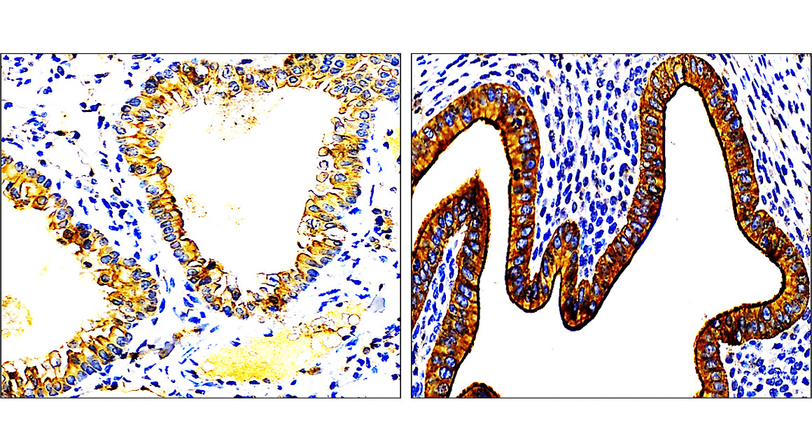 IR228-868 anti-Cytokeratin 7 antibody IHC image IR228-868 anti-Cytokeratin 7 antibody IHC image