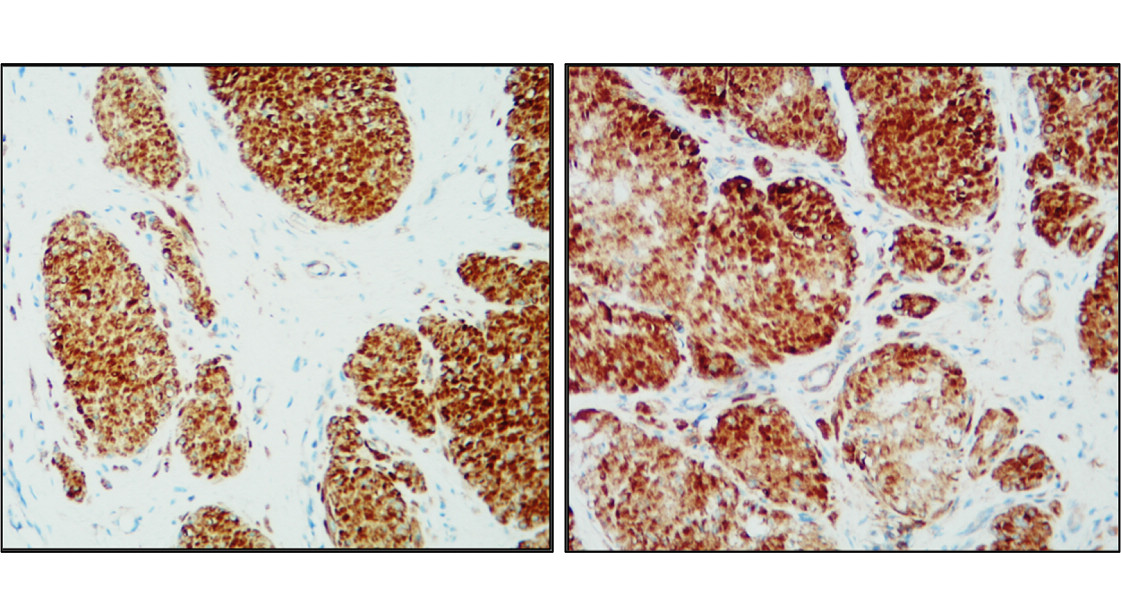 IR2-7 anti-Beta Actin antibody IHC image IR2-7 anti-Beta Actin antibody IHC image