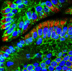 Customer feedback Image IR55-180 anti-E cadherin antibody IHC-Fr image Customer feedback Image IR55-180 anti-E cadherin antibody IHC-Fr image