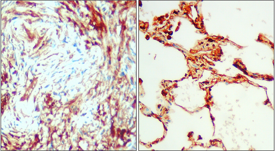 IR74-P1 anti-IL6 antibody IHC image IR74-P1 anti-IL6 antibody IHC image
