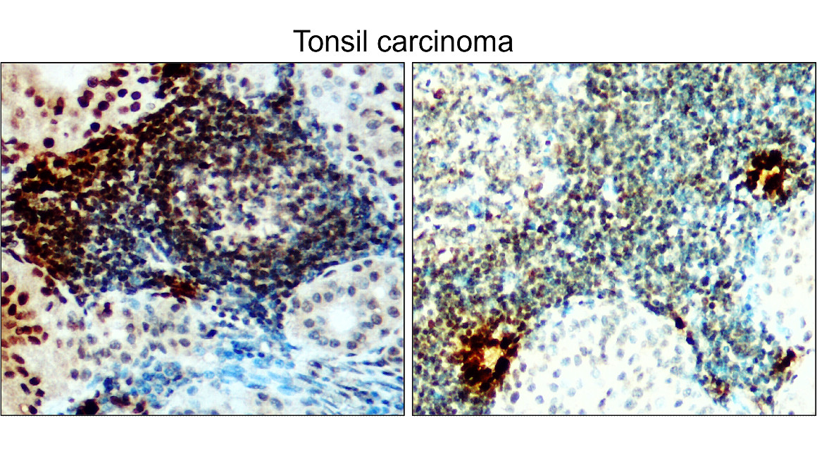 IR127-515 anti-IRE1 alpha antibody IHC image IR127-515 anti-IRE1 alpha antibody IHC image