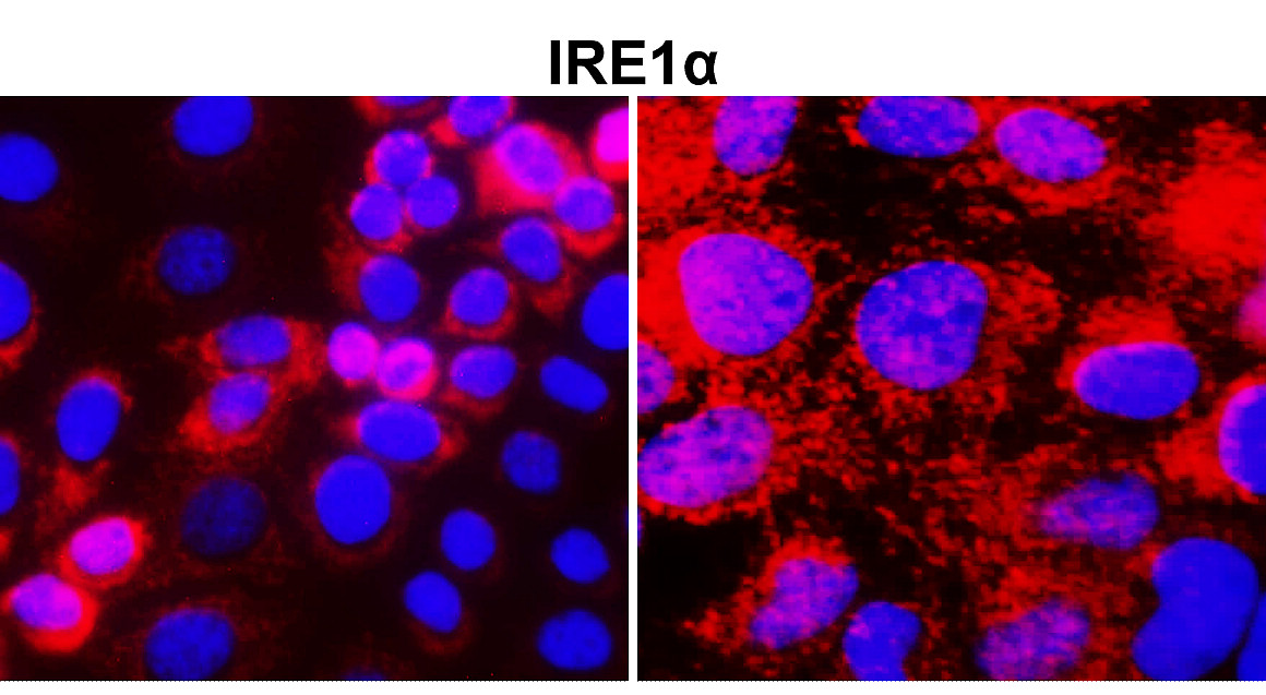 IR127-515 anti-IRE1 alpha antibody ICC/IF image IR127-515 anti-IRE1 alpha antibody ICC/IF image