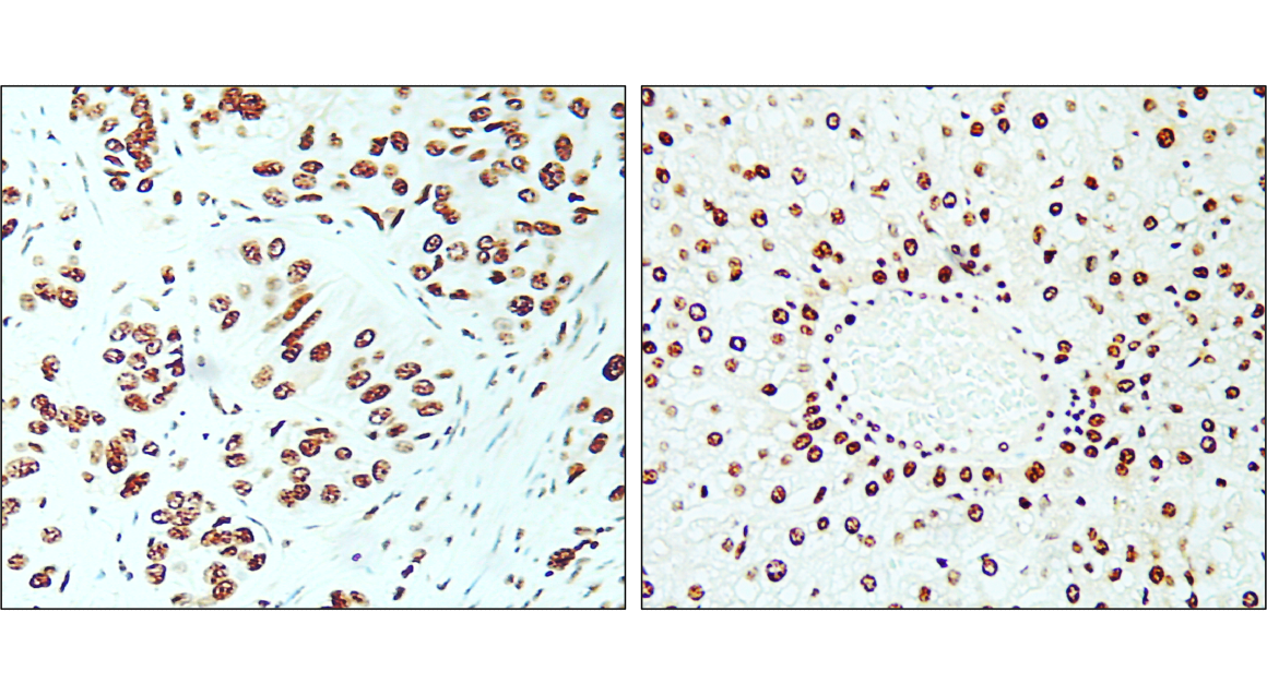 IR212-772 anti- Ki-67 antibody IHC image