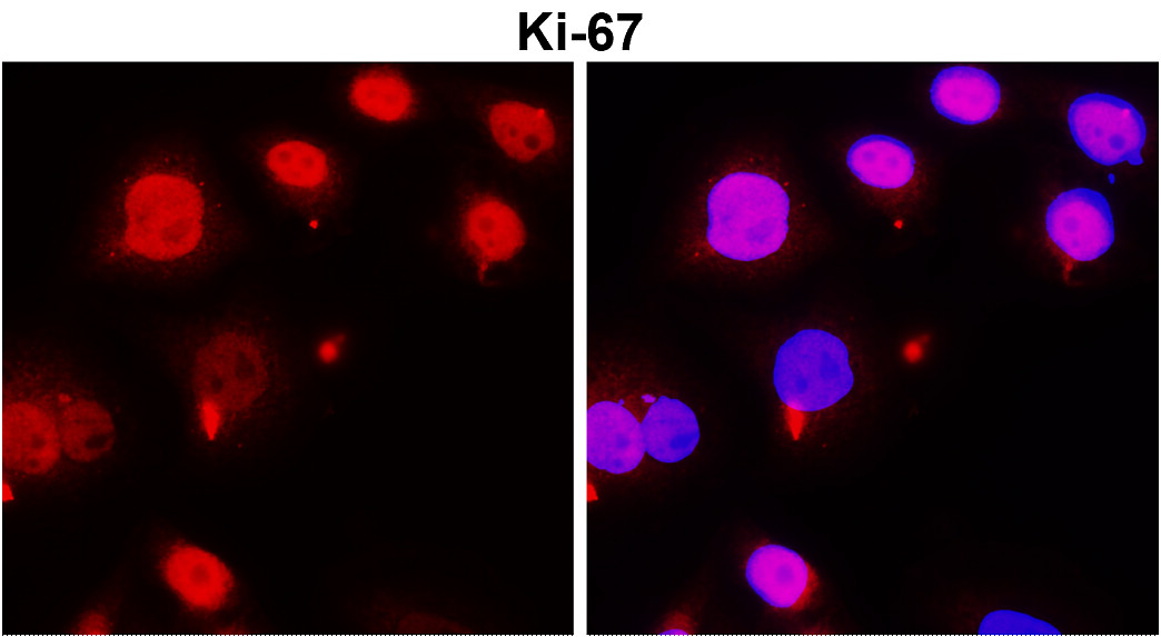 IR212-772 anti- Ki-67 antibody ICC/IF image IR212-772 anti- Ki-67 antibody ICC/IF image