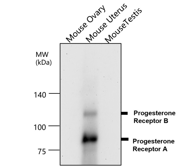 IR215-787 anti- Progesterone Receptor antibody WB image IR215-787 anti- Progesterone Receptor antibody WB image