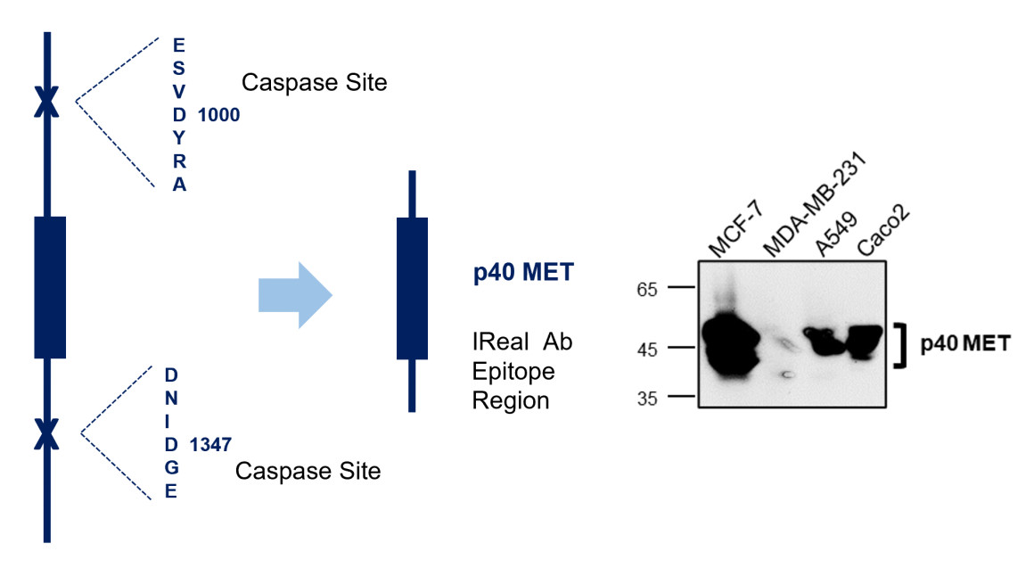 IR219-807 anti c-MET antibody WB image IR219-807 anti c-MET antibody WB image
