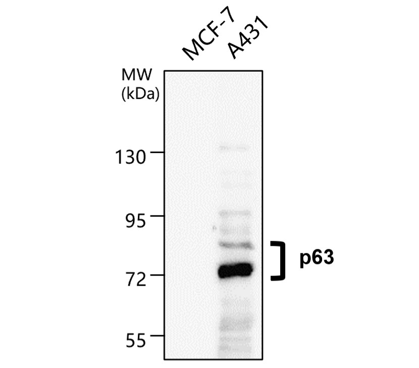 IR205-742 anti- p63 antibody WB image IR205-742 anti- p63 antibody WB image