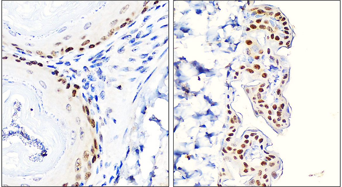 Customer feedback IR205-742 anti- p63 antibody IHC image Customer feedback IR205-742 anti- p63 antibody IHC image
