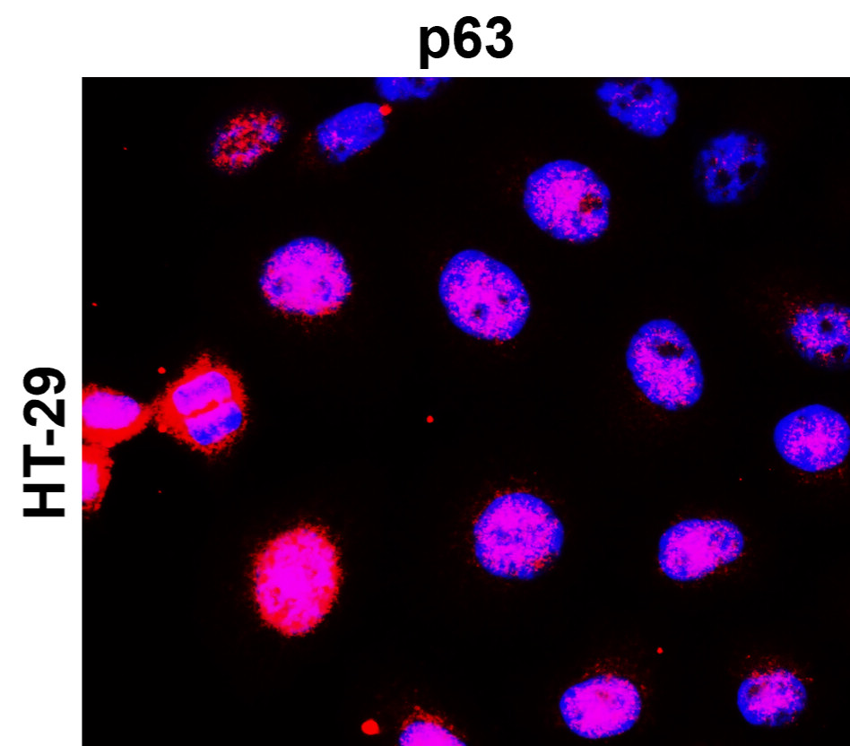 IR205-742 anti- p63 antibody ICC/IF image IR205-742 anti- p63 antibody ICC/IF image